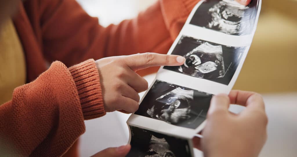 Person holding and pointing to prenatal ultrasound images after IVF Sucess